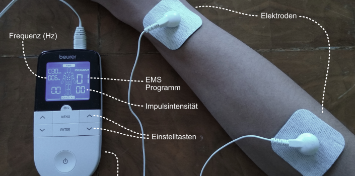 Elektrische Muskelstimulation für Remote Assistance